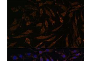 Immunofluorescence analysis of L929 cells using P90RSK Polyclonal Antibody at dilution of 1:100.