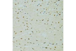 Immunohistochemistry of paraffin-embedded rat heart using RCC1 antibody (ABIN5973761) at dilution of 1/100 (40x lens). (RCC1 抗体)