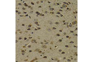 Immunohistochemistry of paraffin-embedded mouse brain using OGG1 antibody at dilution of 1:200 (400x lens). (OGG1 抗体)