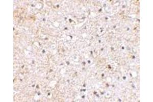 Immunohistochemical staining of human brain tissue using AP30380PU-N Grik1 antibody at 2. (GRIK1 抗体  (C-Term))