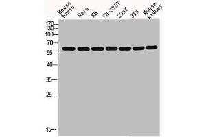 Western blot analysis of mouse-brain HELA KB SH-SY5Y 293T 3T3 Mouse-kidney lysis using GNL3L antibody. (GNL3L 抗体  (Internal Region))