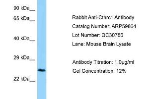 Western Blotting (WB) image for anti-Collagen Triple Helix Repeat Containing 1 (CTHRC1) (C-Term) antibody (ABIN2788242) (CTHRC1 抗体  (C-Term))