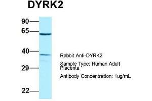 Host: Rabbit  Target Name: DYRK2  Sample Tissue: Human Adult Placenta  Antibody Dilution: 1.