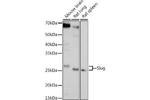 Western blot analysis of extracts of various cell lines, using Slug antibody (ABIN6127298, ABIN6148181, ABIN6148183 and ABIN6217314) at 1:1000 dilution. (SLUG 抗体  (AA 126-268))