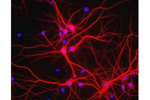 View of mixed neuron/glial cultures stained with MAP2 / MAP-2 antibody (red). (MAP2 抗体)