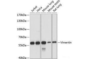 Western blot analysis of extracts of various cell lines using Vimentin Polyclonal Antibody at dilution of 1:1000. (Vimentin 抗体)