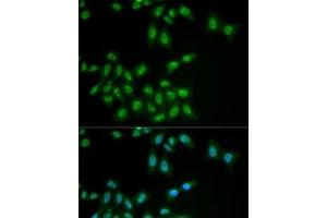Immunofluorescence analysis of MCF7 cells using HPS1 Polyclonal Antibody (HPS1 抗体)