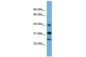 WB Suggested Anti-PPHLN1 Antibody Titration: 0. (PPHLN1 抗体  (N-Term))