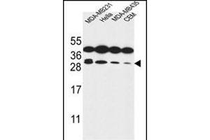 STX10 Antibody (N-term) (ABIN653883 and ABIN2843130) western blot analysis in MDA-M,Hela,MDA-M,CEM cell line lysates (35 μg/lane). (Syntaxin 10 抗体  (N-Term))