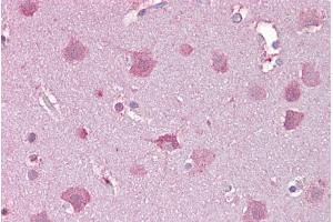 Immunohistochemistry with Brain, cortex tissue at an antibody concentration of 5µg/ml using anti-NDP antibody (ARP56082_P050) (Norrie Disease (Pseudoglioma) 抗体  (Middle Region))
