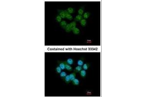 ICC/IF Image Immunofluorescence analysis of paraformaldehyde-fixed A431, using SEPHS2, antibody at 1:500 dilution. (SEPHS2 抗体)