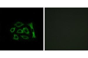 Peptide - +Western blot analysis of extracts from HUVEC cells and COLO cells, using ERD22 antibody. (KDELR2 抗体  (Internal Region))