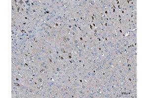 IHC analysis of ARFGAP1 using anti-ARFGAP1 antibody (ABIN4886474). (ARFGAP1 抗体  (AA 1-183))