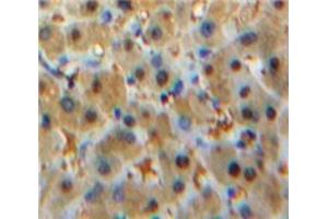 Used in DAB staining on fromalin fixed paraffin-embedded Liver tissue