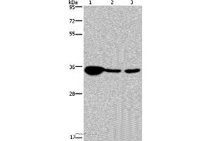 Western blot analysis of Human testis tissue, 293T and A 172 cell, using LZTFL1 Polyclonal Antibody at dilution of 1:300
