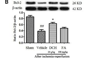 Danshen-Chuanxiong-Honghua extract alleviated apoptosis and inhibited pro-inflammatory cytokine production in the injured hippocampus 24 h after cerebral ischemia and reperfusion. (Bcl-2 抗体  (AA 101-160))