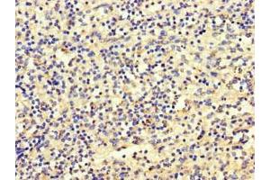 Immunohistochemistry of paraffin-embedded human spleen tissue using ABIN7160637 at dilution of 1:100 (SET Binding Factor 2 抗体  (AA 1585-1813))