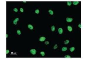 Immunostaining analysis in HeLa cells. (E2F6 抗体)