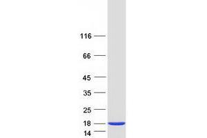 Validation with Western Blot