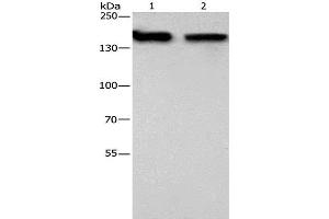 Western Blot analysis of 293T and hela cell using NCAPD2 Polyclonal Antibody at dilution of 1:425 (NCAPD2 抗体)