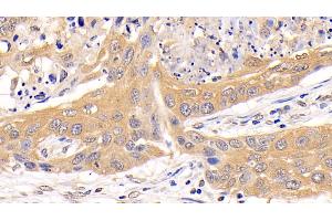 Immunohistochemistry (IHC) image for anti-Protein Kinase, AMP-Activated, alpha 1 Catalytic Subunit (PRKAA1) (AA 28-257) antibody (ABIN7440413)