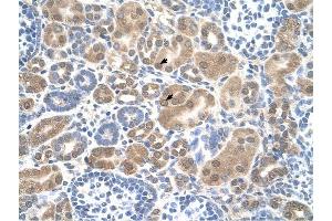 SLC38A1 antibody was used for immunohistochemistry at a concentration of 4-8 ug/ml to stain Epithelial cells of renal tubule (arrows) in Human Kidney.
