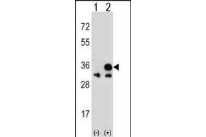 Western Blotting (WB) image for anti-Voltage-Dependent Anion Channel 1 (VDAC1) (AA 1-30), (N-Term) antibody (ABIN390563)
