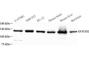 Western blot analysis of EFTUD2 (ABIN7073810) at dilution of 1: 500 (EFTUD2 抗体)