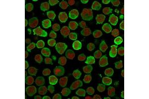 Immunofluorescence (IF) image for anti-Calponin 1 (CNN1) antibody (ABIN6939161)