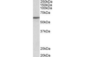 Western Blotting (WB) image for anti-Zinc Finger Protein 703 (ZNF703) (Internal Region) antibody (ABIN2466469) (ZNF703 抗体  (Internal Region))