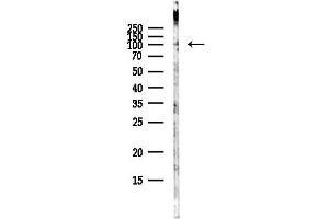 Western blot analysis of lysates from HepG2 cells(heat-shock,45 min treatment), using RAPGEF3 Antibody at 1/1000 dilution.