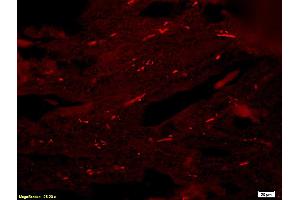Formalin-fixed and paraffin-embedded : rat breast tissue labeled with Rabbit Anti-Reprimo Polyclonal Antibody (ABIN735863), Unconjugated 1:200 followed by conjugation to the secondary PE antibody (Reprimo 抗体  (AA 41-109))