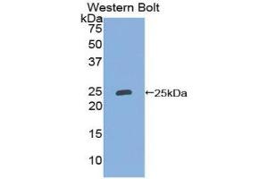 Western Blotting (WB) image for anti-Lipocalin 2 (LCN2) (AA 21-198) antibody (ABIN3206738) (Lipocalin 2 抗体  (AA 21-198))