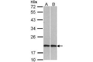 WB Image Sample (30 ug of whole cell lysate) A: H1299 B: Molt-4 , 12% SDS PAGE antibody diluted at 1:1000 (Cofilin 2 抗体)