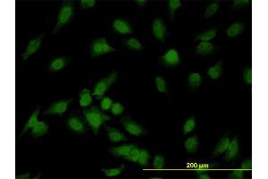 Immunofluorescence of monoclonal antibody to IRAK1 on HeLa cell. (IRAK1 抗体  (AA 530-693))