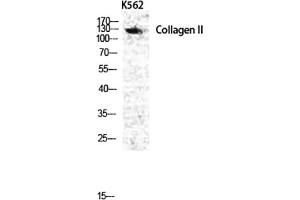 Western Blot analysis of various cells using COL2A1 Polyclonal Antibody diluted at 1:1000. (COL2A1 抗体  (AA 70-150))