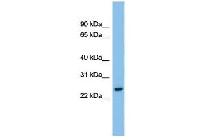 AK2 antibody used at 1 ug/ml to detect target protein. (Adenylate Kinase 2 抗体  (Middle Region))