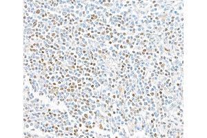 Immunohistochemistry (IHC) image for anti-Transcription Factor 7 (T-Cell Specific, HMG-Box) (TCF7) (AA 200-250) antibody (ABIN7449420) (Recombinant TCF7 抗体  (AA 200-250))
