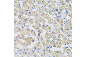 Immunohistochemistry of paraffin-embedded human liver injury using SNAP29 antibody at dilution of 1:100 (x40 lens). (SNAP29 抗体)