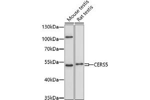 Western blot analysis of extracts of various cell lines, using CERS5 antibody (ABIN7268175) at 1:1000 dilution. (LASS5 抗体  (AA 1-100))