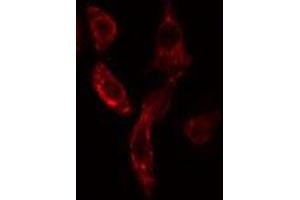 ABIN6275886 staining COLO205 cells by IF/ICC. (VASH1 抗体  (Internal Region))
