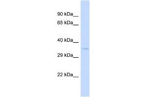 Host:  Rabbit  Target Name:  SPPL2B  Sample Type:  293T Whole cell lysates  Antibody Dilution:  1. (SPPL2B 抗体  (N-Term))