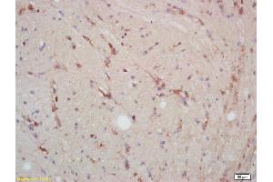 Immunohistochemistry (IHC) image for anti-Mitogen-Activated Protein Kinase 14 (MAPK14) (AA 141-240) antibody (ABIN671241)