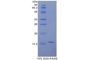 SDS-PAGE analysis of Rat Galactosylceramidase Protein. (GALC 蛋白)