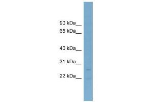 NT5M antibody used at 1 ug/ml to detect target protein. (NT5M 抗体  (Middle Region))