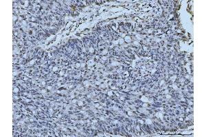 IHC analysis of MRE11 using anti-MRE11 antibody (ABIN7600025).