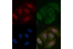 SSH3 Mouse Monoclonal Antibody staining Hela cells by IF/ICC. (SSH3 抗体  (N-Term))