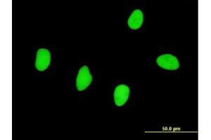 Immunofluorescence of monoclonal antibody to RBMS2 on HeLa cell. (RBMS2 抗体  (AA 308-407))