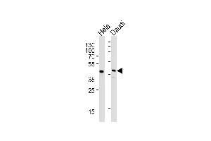 Western blot analysis of lysates from Hela,Daudi cell line (from left to right),using CREB3L4 Antibody (monoclonal) (M01) (ABIN1882056 and ABIN2838484). (USF1 抗体  (AA 1-310))