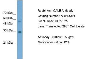 WB Suggested Anti-GALE  Antibody Titration: 0. (GALE 抗体  (Middle Region))